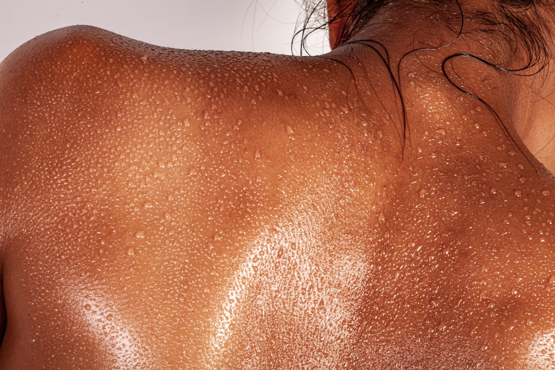 Melasma on Dark Skin: Safe Treatment That Works
