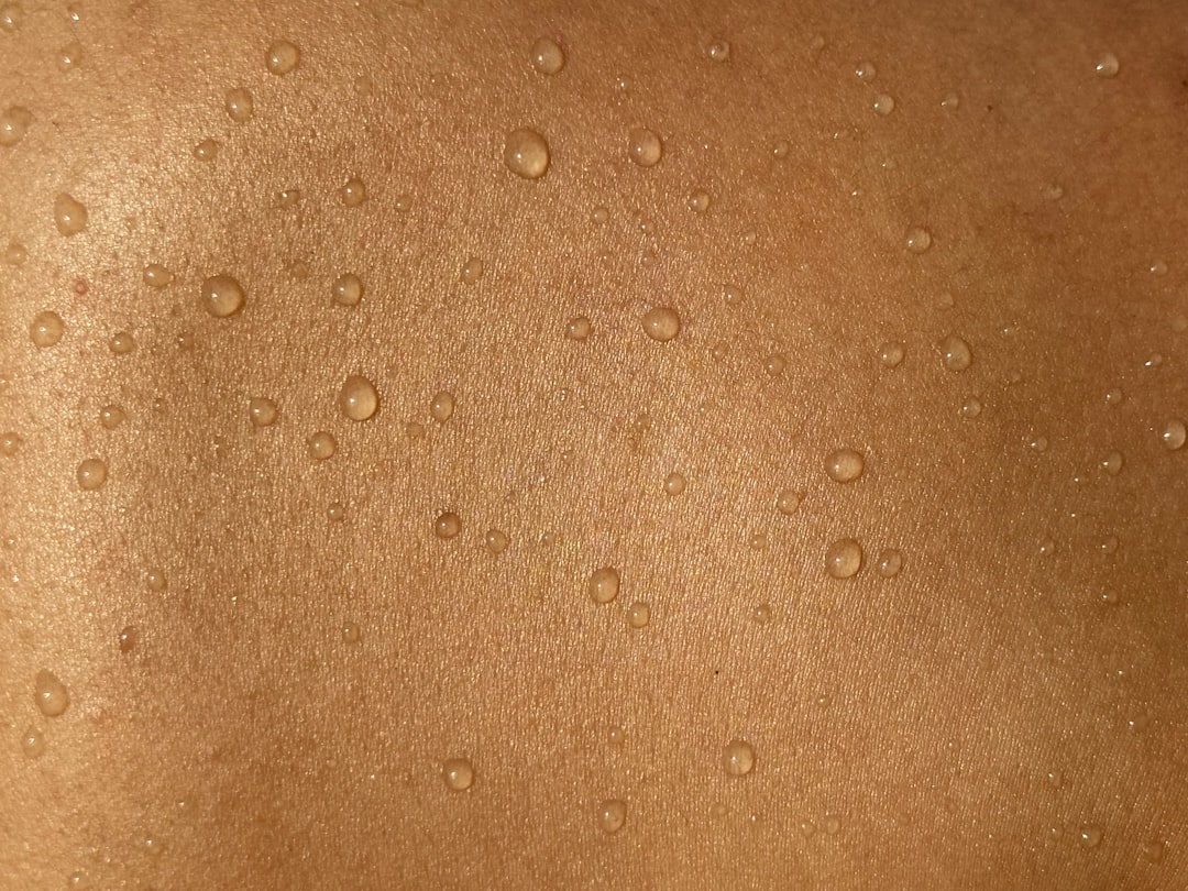Melasma on Dark Skin: Safe Treatment That Works