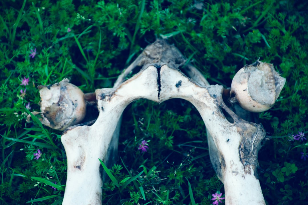 Natural Osteoporosis Management: Diet, Exercise, and Supplements